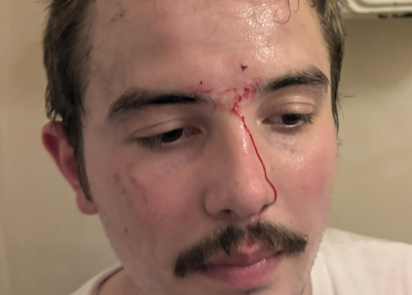 Deux journalistes de Frontières agressés en marge du rassemblement de LFI à Paris Deux journalistes de Frontières agressés en marge du rassemblement de LFI à Paris